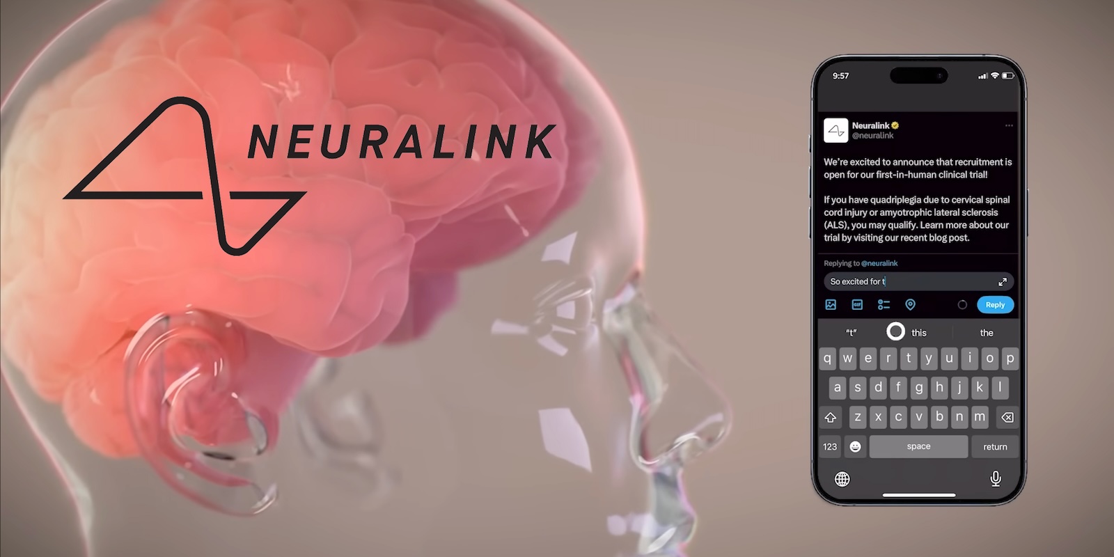 Elon Musk's Neuralink Brain-Chip Implant Facing Unexpected Challenge